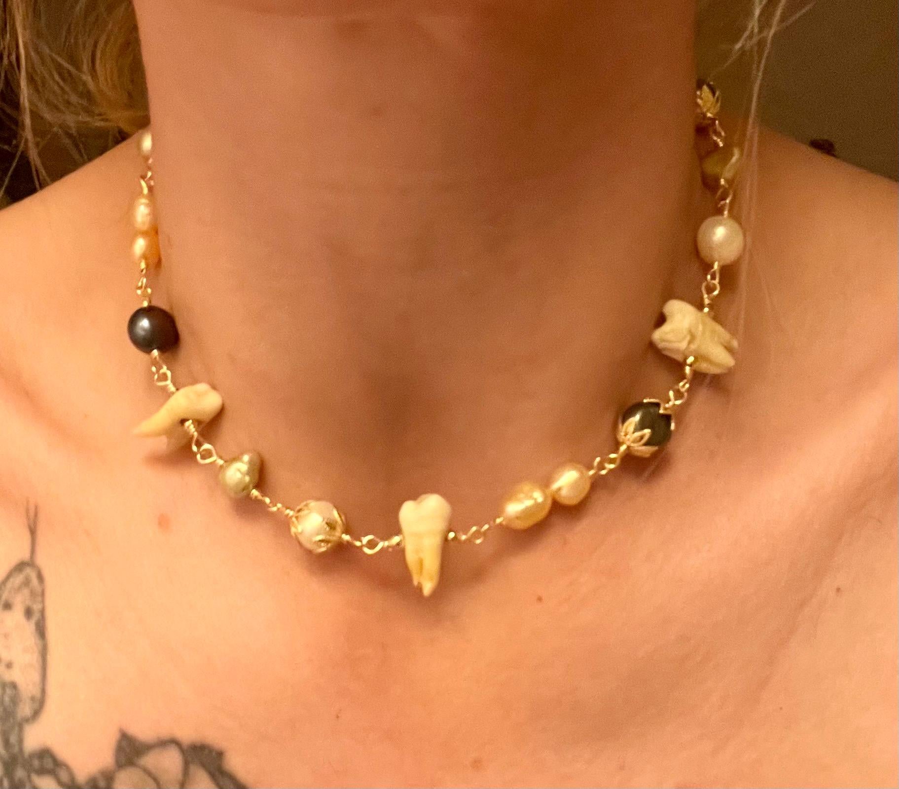 Mixed Freshwater Pearl Necklace with Three Human Teeth, 15”